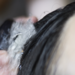 薄毛など気になるエイジングサインに対応のmarbb（マーブ）と発毛医療